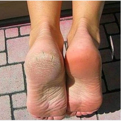  Bien être du pied pour femme