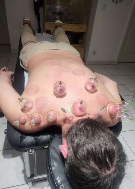 Massage détente au ventouses