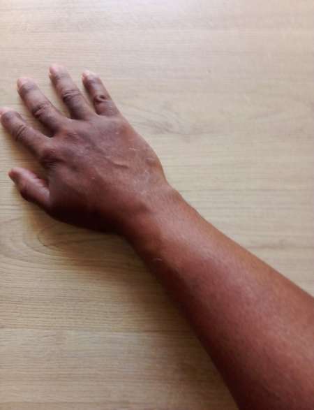 Naturopathe à domicile