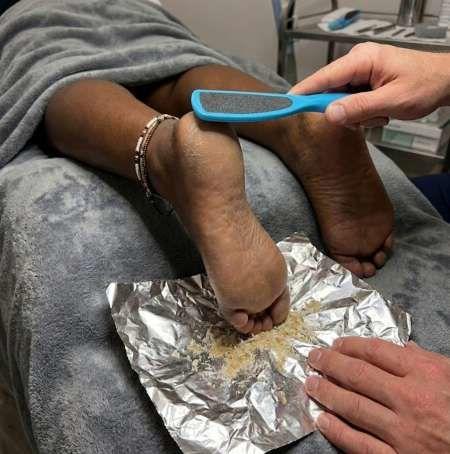 Entretien des pied pour femme