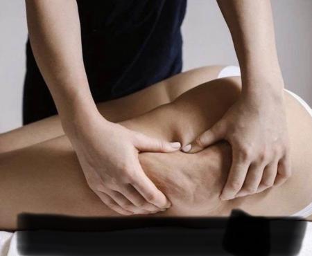 Palper-rouler contre la cellulite